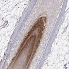 Immunohistochemical staining of human skin, hairy using Anti-GSDMA antibody HPA064826.