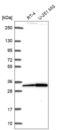 Anti-CXorf56 Antibody