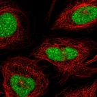 Immunofluorescent staining of human cell line SiHa shows localization to nucleus & centrosome.