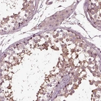 Immunohistochemical staining of human testis shows high expression.