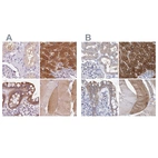 Anti-UGP2 Antibody