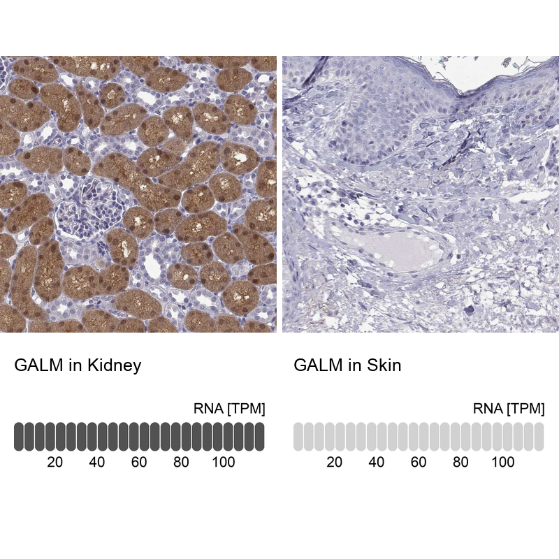 Anti-GALM Antibody