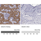 Anti-GALM Antibody