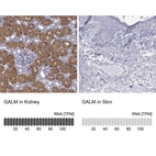 Anti-GALM Antibody