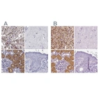 Immunohistochemical staining of human adrenal gland, cerebral cortex, kidney and skin using Anti-GALM antibody HPA064835 (A) shows similar protein distribution across tissues to independent antibody HPA035472 (B).