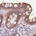 Immunohistochemical staining of human rectum using Anti-UGP2 antibody HPA064836.