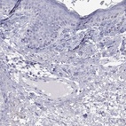 Immunohistochemical staining of human skin shows low expression as expected.