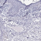Immunohistochemical staining of human skin shows low expression as expected.
