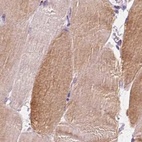 Immunohistochemical staining of human skeletal muscle using Anti-UGP2 antibody HPA064836.