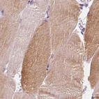 Immunohistochemical staining of human skeletal muscle using Anti-UGP2 antibody HPA064836.