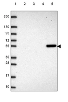 Lane 1: Marker [kDa] 250, 130, 95, 72, 55, 36, 28, 17, 10_br/_Lane 2: Human cell line RT-4_br/_Lane 3: Human cell line U-251 MG_br/_Lane 4: Human plasma_br/_Lane 5: Human Liver tissue
