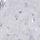 Immunohistochemical staining of human cerebral cortex using Anti-GALM antibody HPA064835.