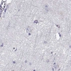 Immunohistochemical staining of human cerebral cortex using Anti-GALM antibody HPA064835.