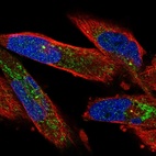 Immunofluorescent staining of human cell line RH-30 shows localization to mitochondria & centrosome.