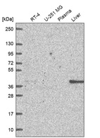 Western blot analysis in human cell line RT-4, human cell line U-251 MG, human plasma and human liver tissue.