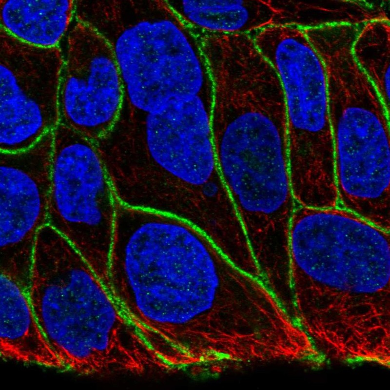 Anti-KIAA1522 Antibody