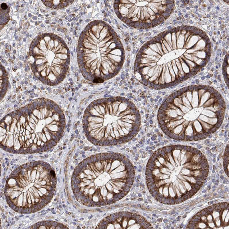 Anti-SPICE1 Antibody