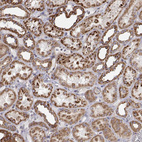 Immunohistochemical staining of human kidney shows strong granular cytoplasmic positivity in cells in tubules.