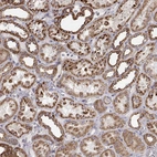 Immunohistochemical staining of human kidney shows strong granular cytoplasmic positivity in cells in tubules.