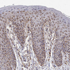 Immunohistochemical staining of human skin shows strong granular cytoplasmic positivity in squamous epithelial cells.