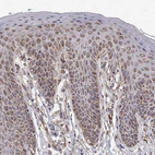 Immunohistochemical staining of human skin shows strong granular cytoplasmic positivity in squamous epithelial cells.