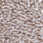 Immunohistochemical staining of human liver shows strong granular cytoplasmic positivity in hepatocytes.