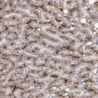 Immunohistochemical staining of human liver shows strong granular cytoplasmic positivity in hepatocytes.