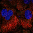 Immunofluorescent staining of human cell line A-431 shows localization to centrosome.