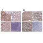 Anti-ACOX2 Antibody