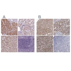 Immunohistochemical staining of human heart muscle, kidney, liver and tonsil using Anti-ACOX2 antibody HPA064845 (A) shows similar protein distribution across tissues to independent antibody HPA038280 (B).
