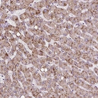 Immunohistochemical staining of human liver shows moderate granular cytoplasmic positivity in hepatocytes.