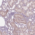 Immunohistochemical staining of human kidney shows weak granular cytoplasmic positivity in cells in tubules.