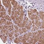 Immunohistochemical staining of human heart muscle shows moderate granular cytoplasmic positivity in cardiomyocytes.