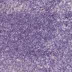 Anti-ACOX2 Antibody