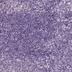 Immunohistochemical staining of human tonsil shows no positivity in non-germinal center cells as expected.