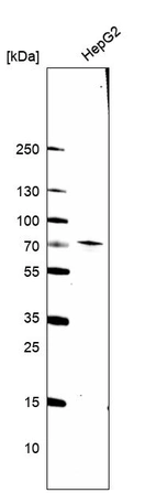 Western blot analysis in human cell line HepG2.