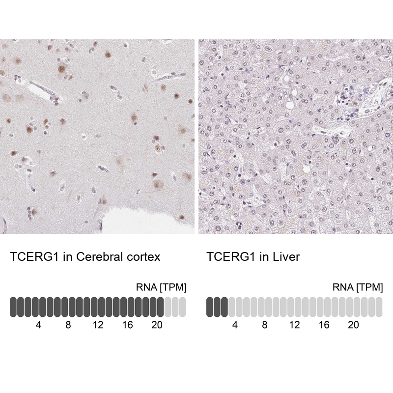 Anti-TCERG1 Antibody