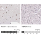 Anti-TCERG1 Antibody