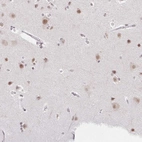 Immunohistochemical staining of human cerebral cortex shows high expression.