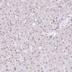 Immunohistochemical staining of human liver shows low expression as expected.