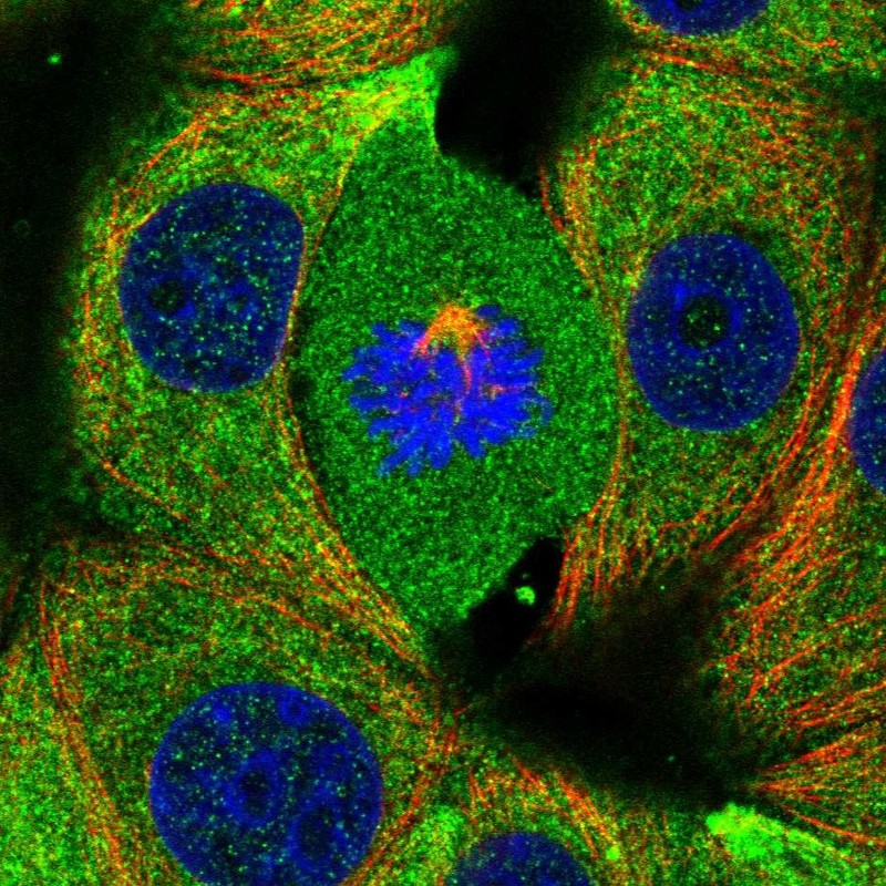 Anti-RABGAP1 Antibody