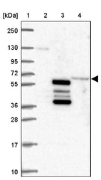 Lane 1: Marker [kDa] 250, 130, 95, 72, 55, 36, 28, 17, 10_br/_Lane 2: Human cell line RT-4_br/_Lane 3: Human cell line U-251 MG_br/_Lane 4: Human plasma