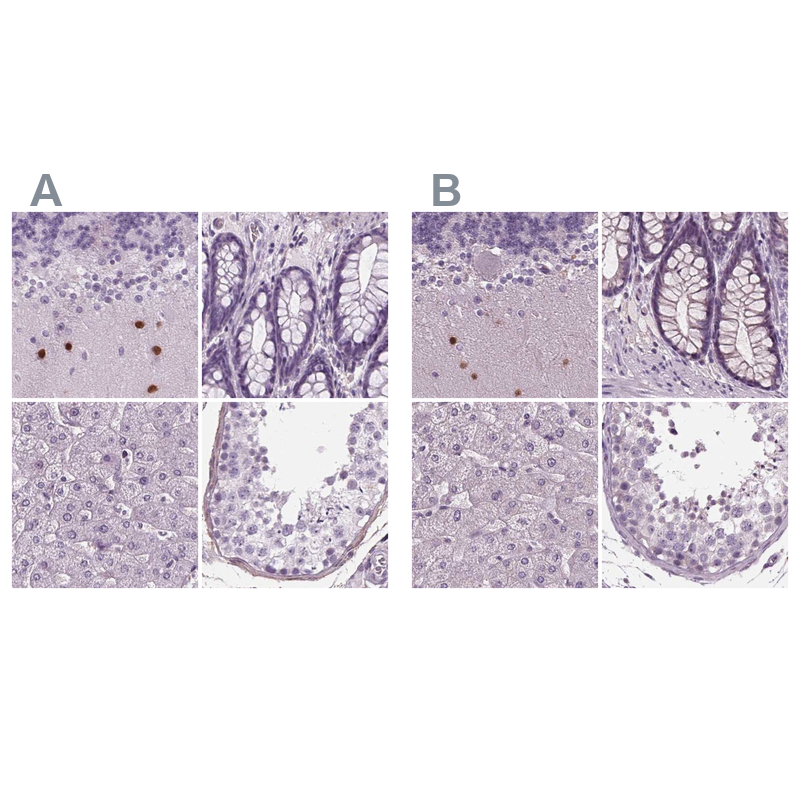 Anti-BHLHE22 Antibody