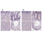 Anti-BHLHE22 Antibody