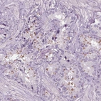 Immunohistochemical staining of human seminal vesicle shows moderate nuclear positivity in glandular cells.