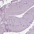 Immunohistochemical staining of human skeletal muscle shows no positivity in myocytes as expected.
