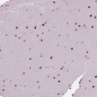Immunohistochemical staining of human cerebellum shows strong nuclear positivity in cells in molecular layer.
