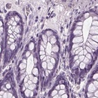 Immunohistochemical staining of human colon using Anti-BHLHE22 antibody HPA064872.
