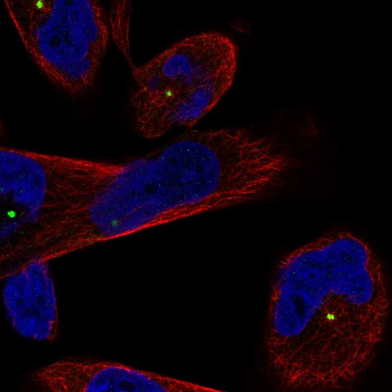 Anti-CEP250 Antibody