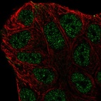 Anti-ABCA6 Antibody